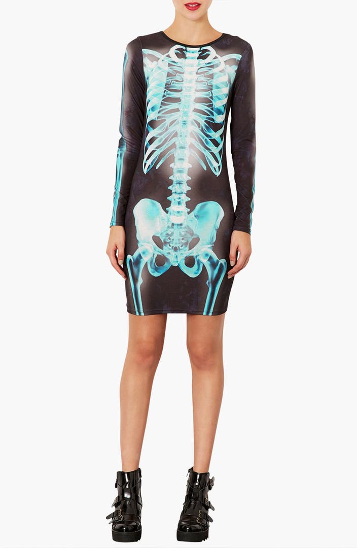 Topshop X  Ray  Skeleton Print Body Con Dress  Nordstrom