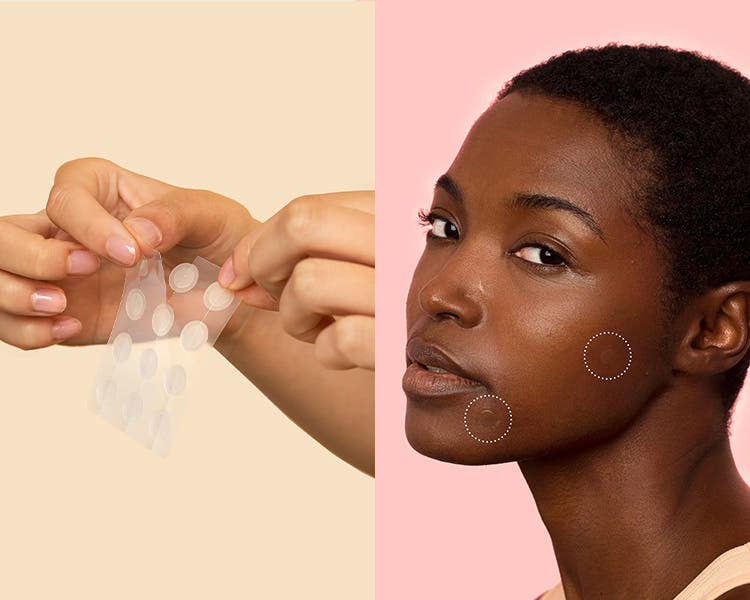 When to Use Acne Patch: Essential Tips for Clear Skin