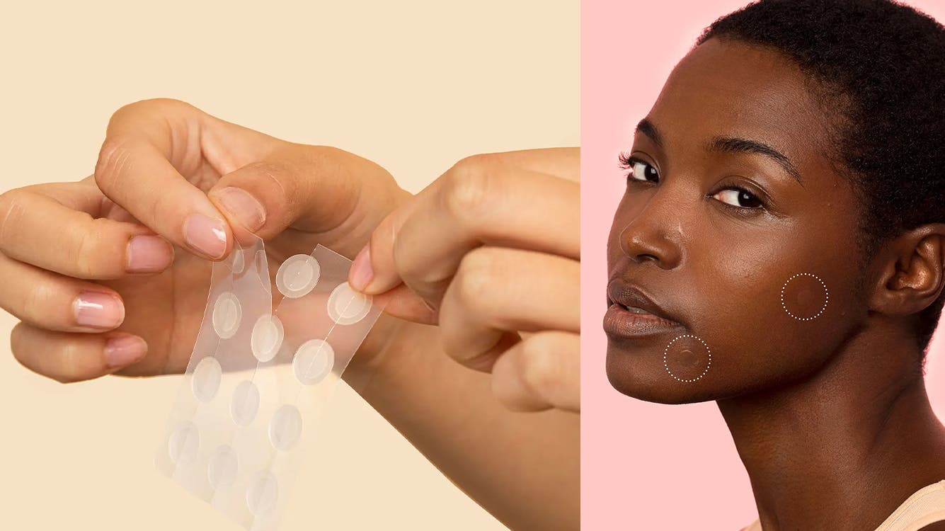 What Are Pimple Patches and How Do They Work?