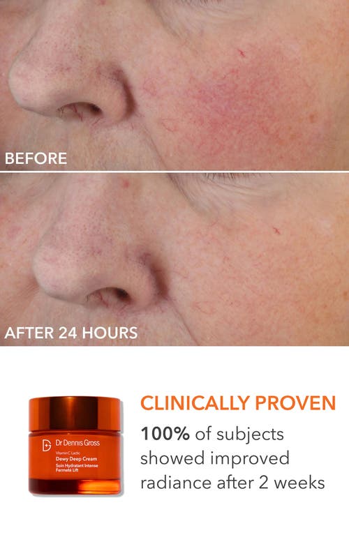 Dr Dennis Gross Skincare Dr. Dennis Gross Skincare Dewy Duo $154 Value In No Color