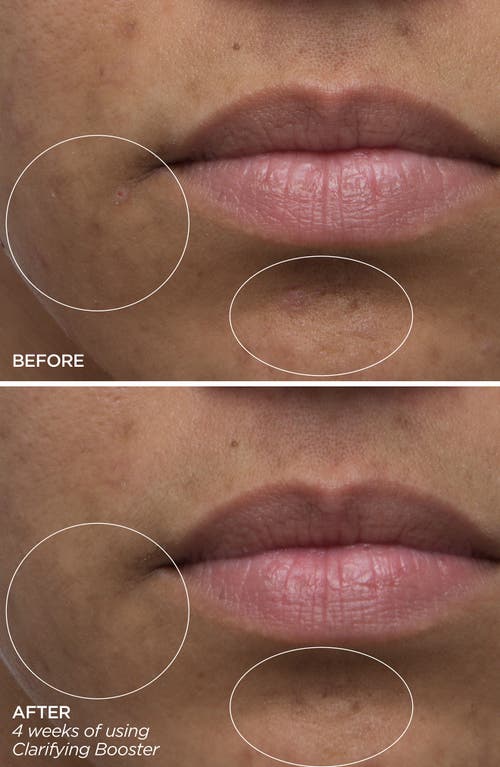 Beautybio Clarifying Salicylic Acid Booster Serum In No Color