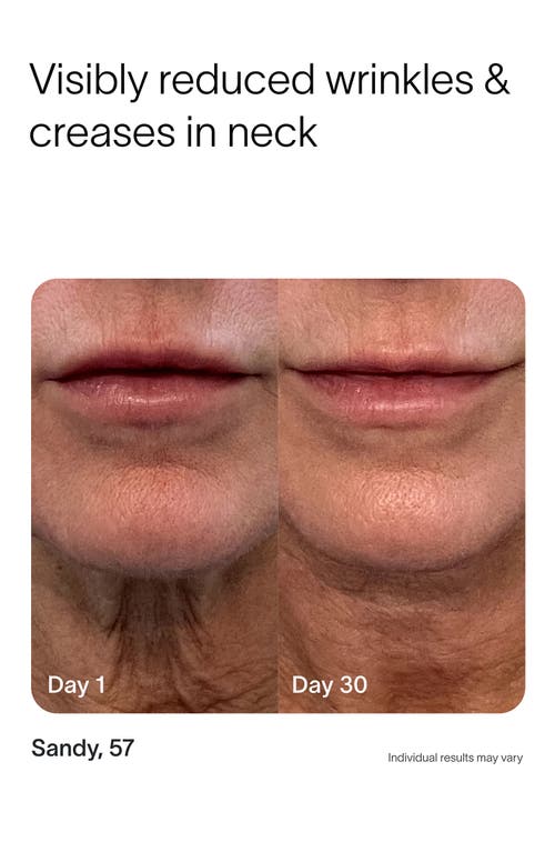 Solawave 4-in-1 Skin Care Wand In Charcoal