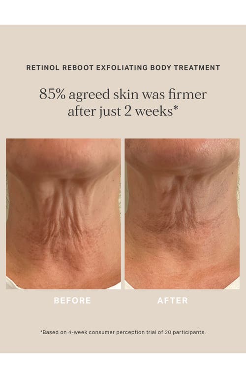 Alpha-h Retinol Reboot Exfoliating Body Treatment With 8% Glycolic Acid 2% Lactic Acid + 1% Encapsuladed Ret In No Color
