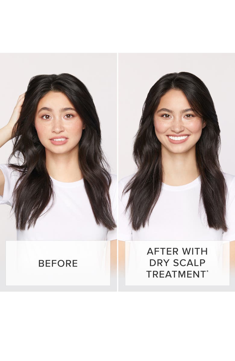 LIVING PROOF<SUP>®</SUP> Restore Dry Scalp Treatment, Alternate, color, NO COLOR