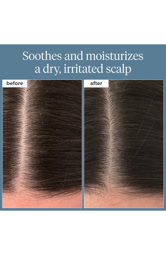 Briogeo Scalp Revival Rosemary Pre-wash Oil For Hair And Scalp