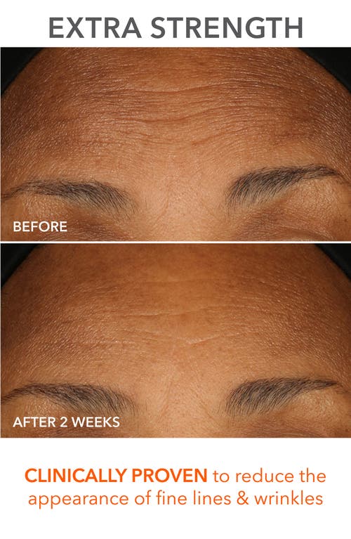 Dr Dennis Gross Skincare Dr. Dennis Gross Skincare The Science Of Glow Set $245 Value In No Color