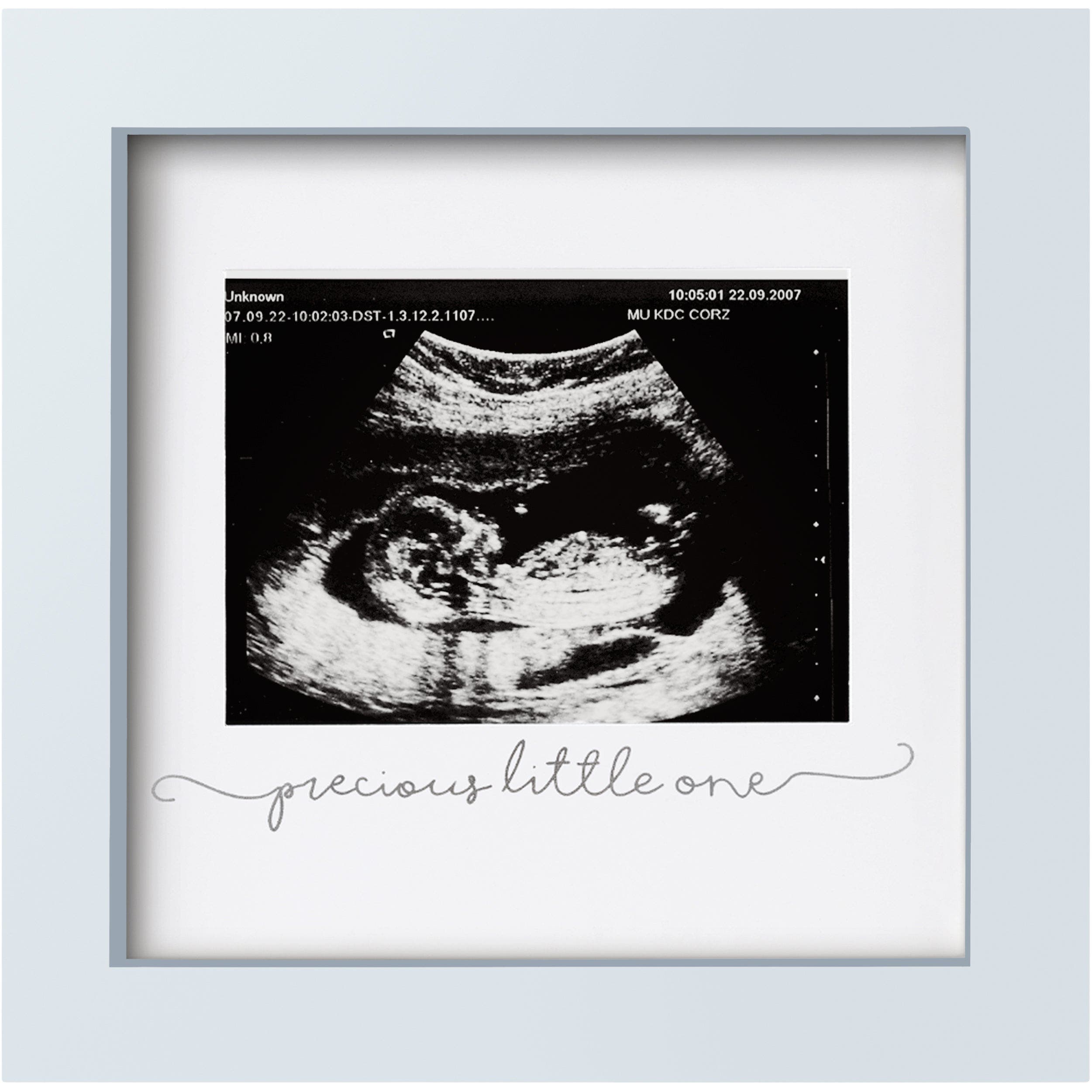 Keababies Kids'  Solo Baby Sonogram Frame In Mist Blue