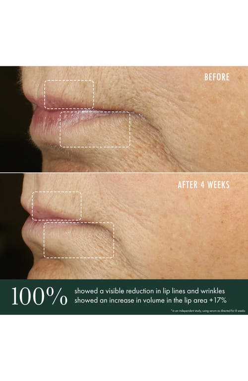 Revive Révive® Advanced Lip Perioral Serum Targeted Vertical Line Filler