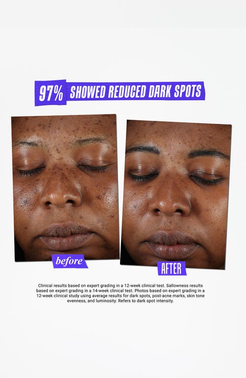 Shop Kiehl's Since 1851 Clearly Corrective™ Dark Spot Solution In No Color