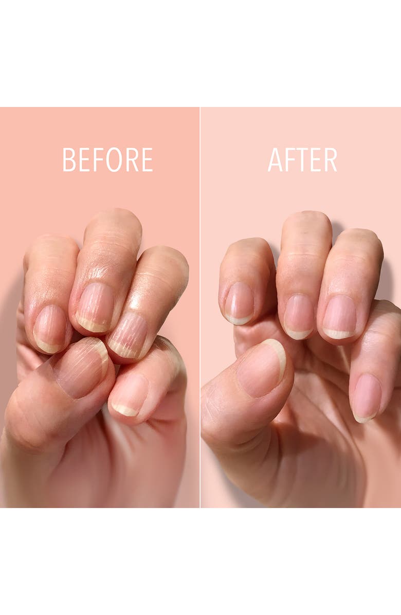 Londontown Fortifying Ridge Filler Nail Polish Nordstrom