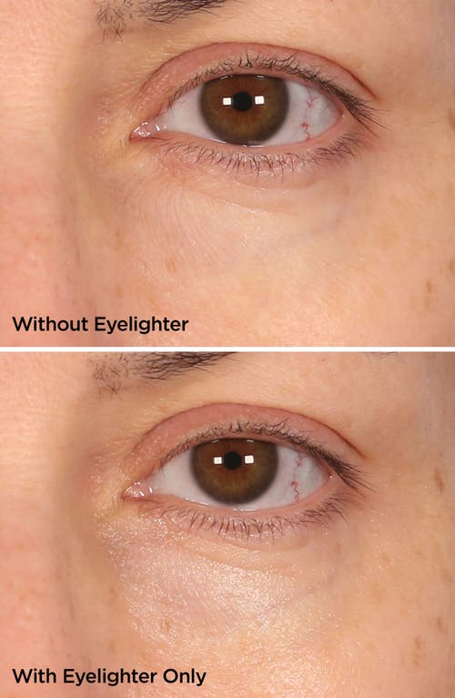 Beautybio The Eyelighter Concentrate Smoothing, Brightening Serum & Depuffing Tool In No Color