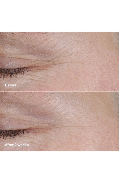 Clinique Smart Clinical Repair Am/pm Retinoid Balm In No Color