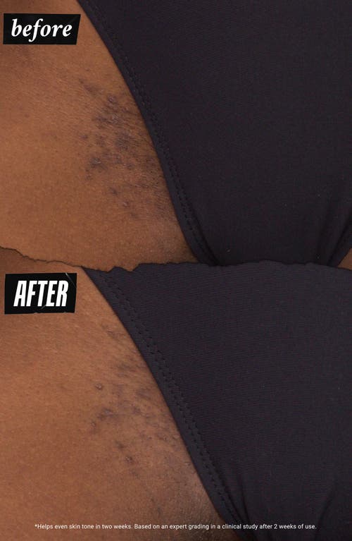 Kiehl's Since 1851 Ingrown Hair & Tone-correcting Intimate Drops In No Color