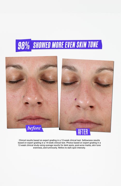 Shop Kiehl's Since 1851 Clearly Corrective™ Dark Spot Solution In No Color