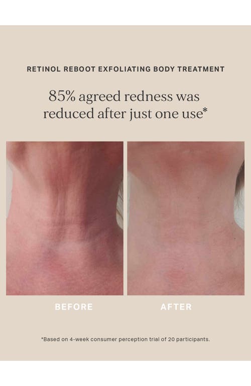 Alpha-h Retinol Reboot Exfoliating Body Treatment With 8% Glycolic Acid 2% Lactic Acid + 1% Encapsuladed Ret In No Color