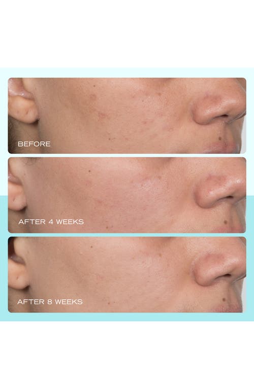 First Aid Beauty Dark Spot Serum With Niacinamide In No Color