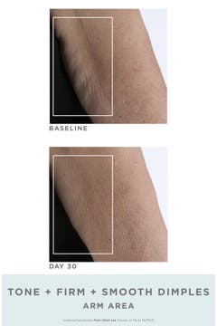 nuface nubody toning