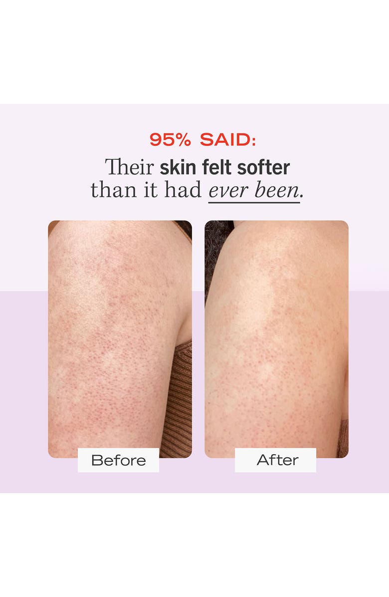 First Aid Beauty KP Bump Eraser Body Scrub Nordstrom