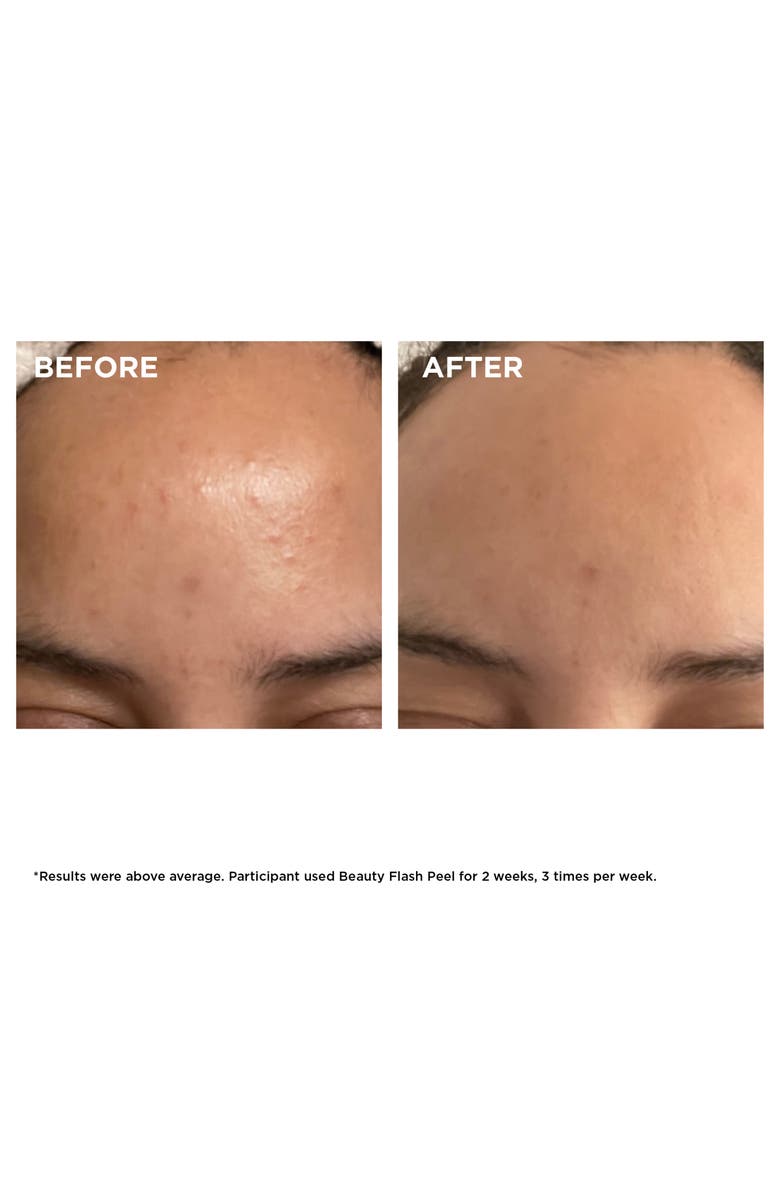 Clarins Beauty Flash Peel with BHA & AHA | Nordstrom