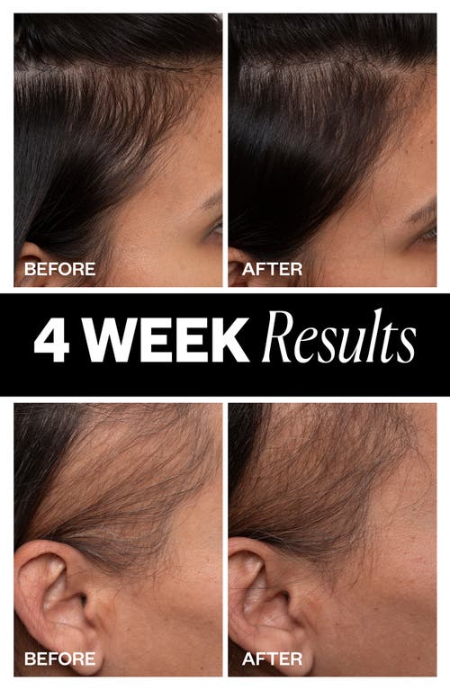 Igk Sponsored Hair Density Scalp Treatment For Thinning Hair 2.1 oz / 63 ml In No Color