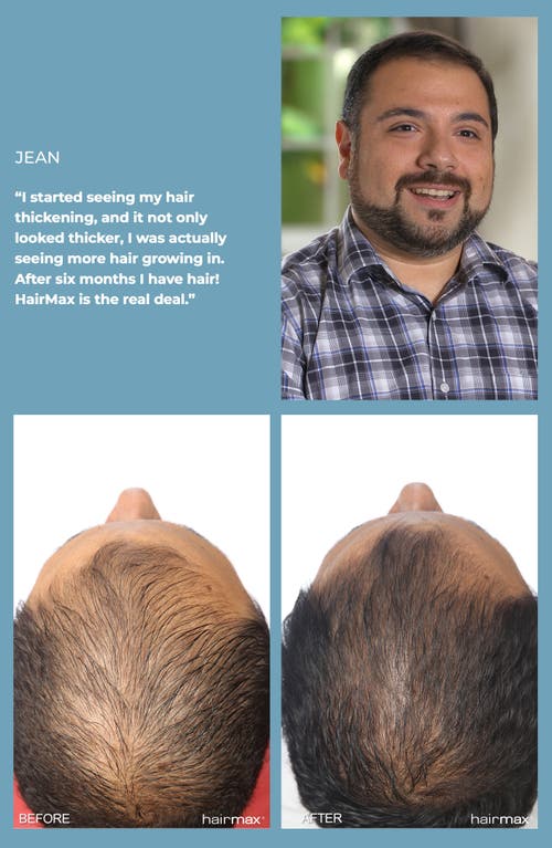 Hairmax ® Laserband 82 Comfortflex Hair Growth Device In Transparent