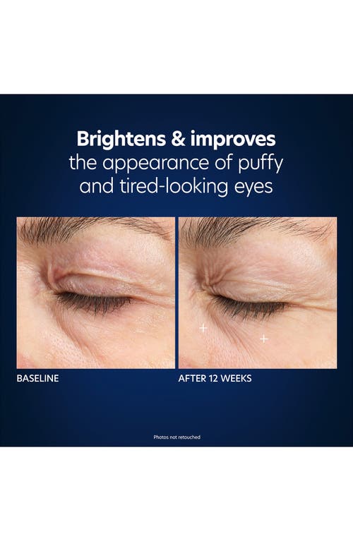 Pca Skin Hyaluronic Acid Microneedle Eye Patches In White