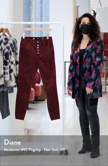 KUT from the Kloth Donna Exposed Button 