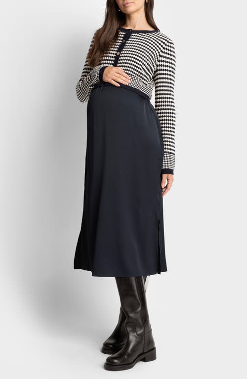 SERAPHINE SERAPHINE MIDI DRESS & SCALLOP CARDIGAN MATERNITY/NURSING SET 
