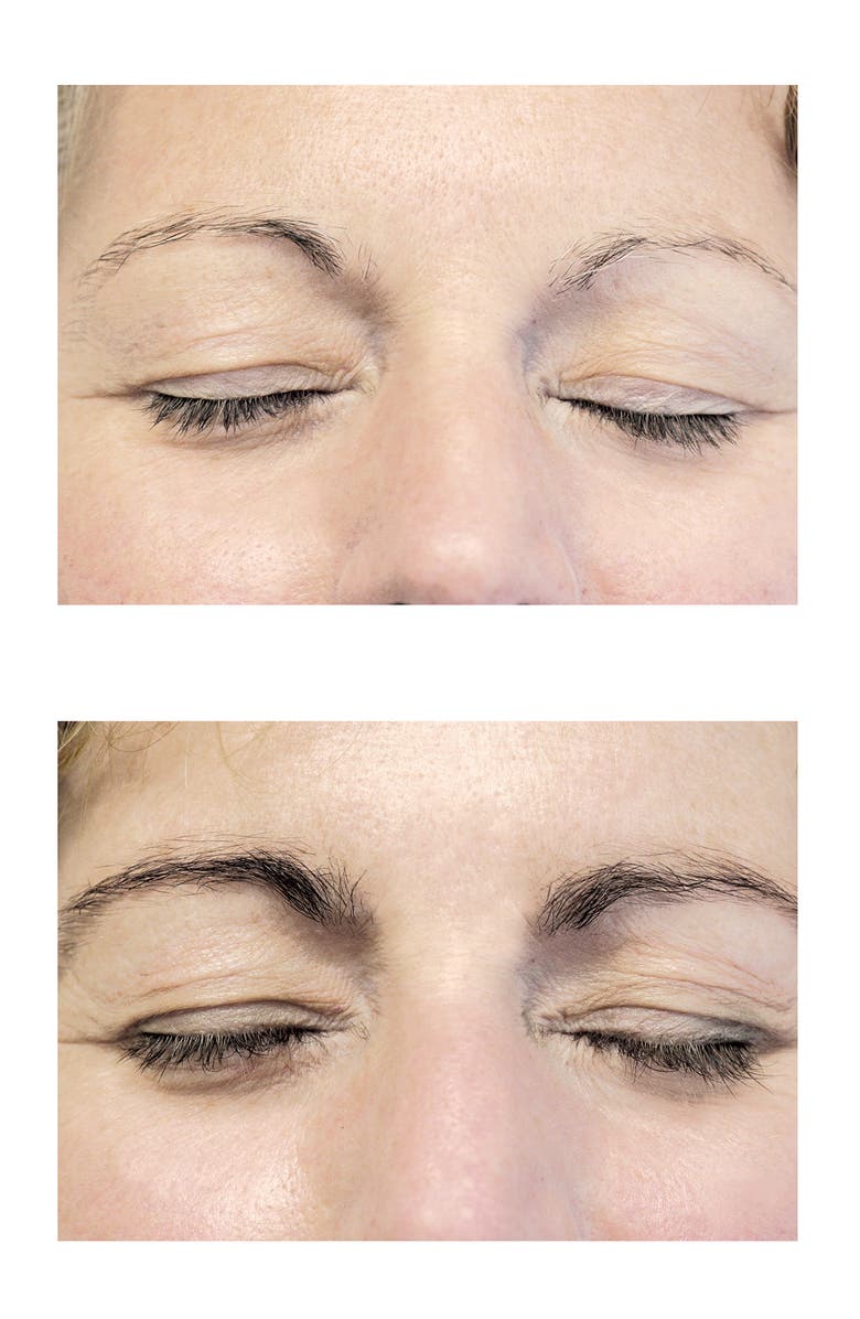 Neulash® Neubrow® Brow Enhancing Serum Nordstrom