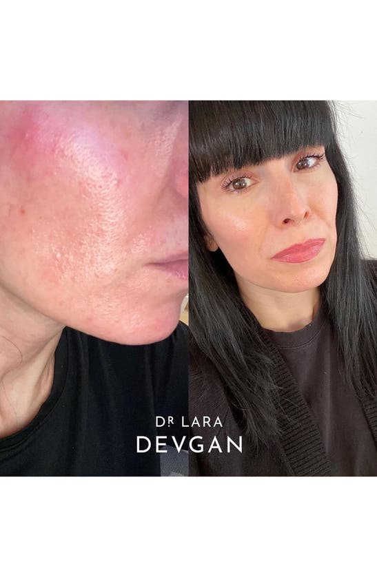 Dr Lara Devgan Dr. Lara Devgan Retinol + Bakchiol Serum In 2.5x