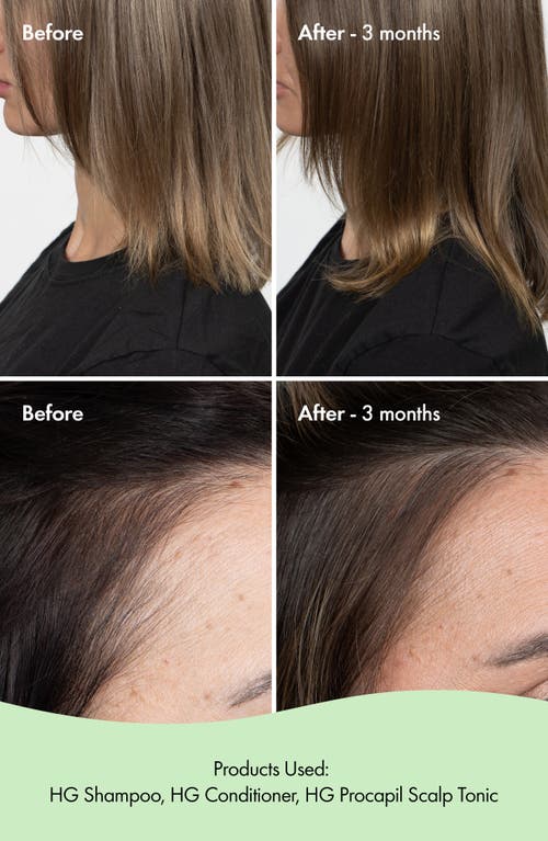Bondiboost Bondi Boost Hg Anti-thinning Conditioner In No Color