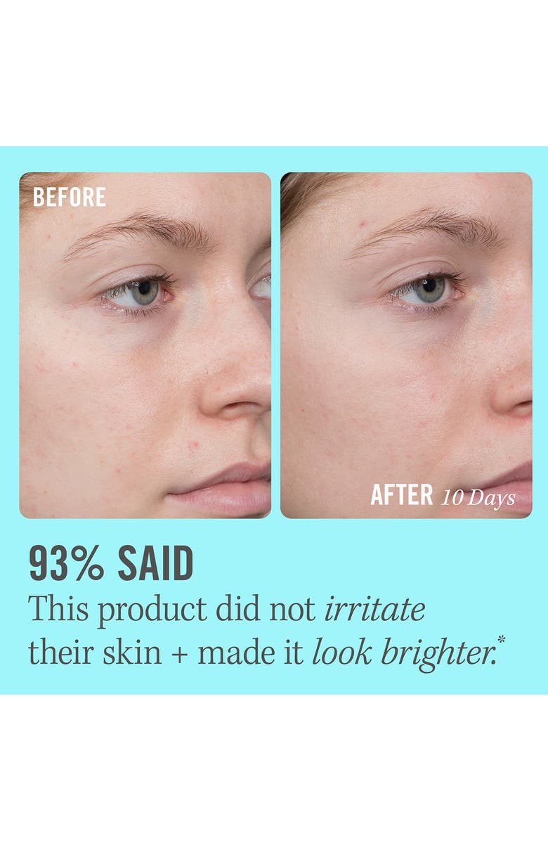 First Aid Beauty 10 Vitamin C Brightening Serum Nordstrom