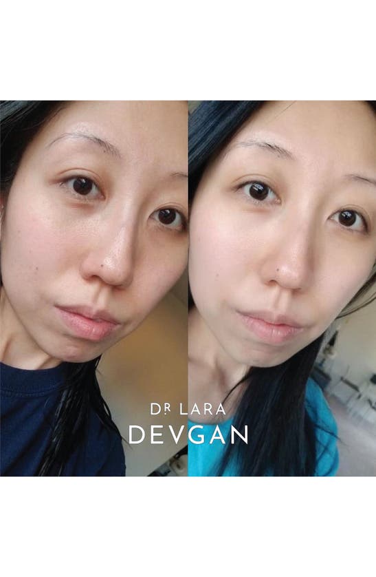 Dr Lara Devgan Hyaluronic Serum