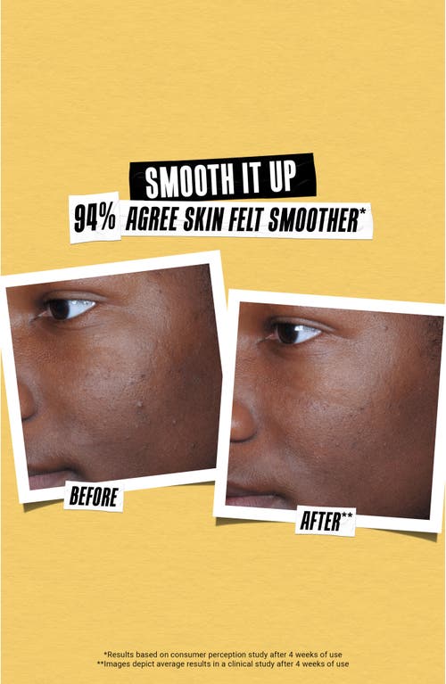 Kiehl's Since 1851 Better Screen Uv Serum In No Color