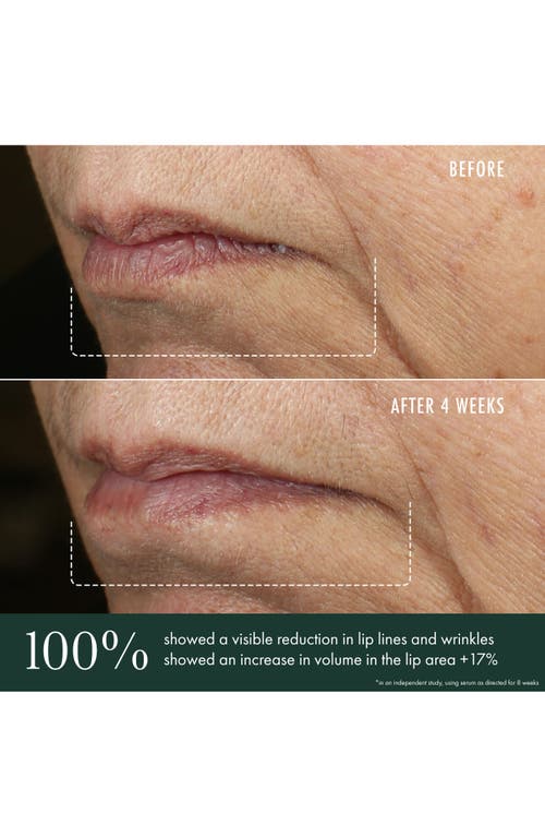 Revive Révive® Advanced Lip Perioral Serum Targeted Vertical Line Filler