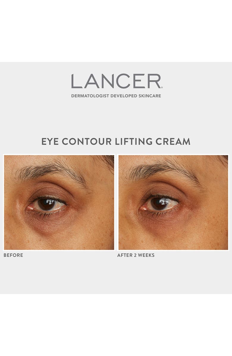 LANCER Skincare Eye Contour Lifting Cream Nordstrom