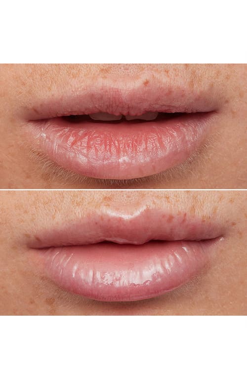 Wonderskin Lip Rehab Serum-in-oil In No Color