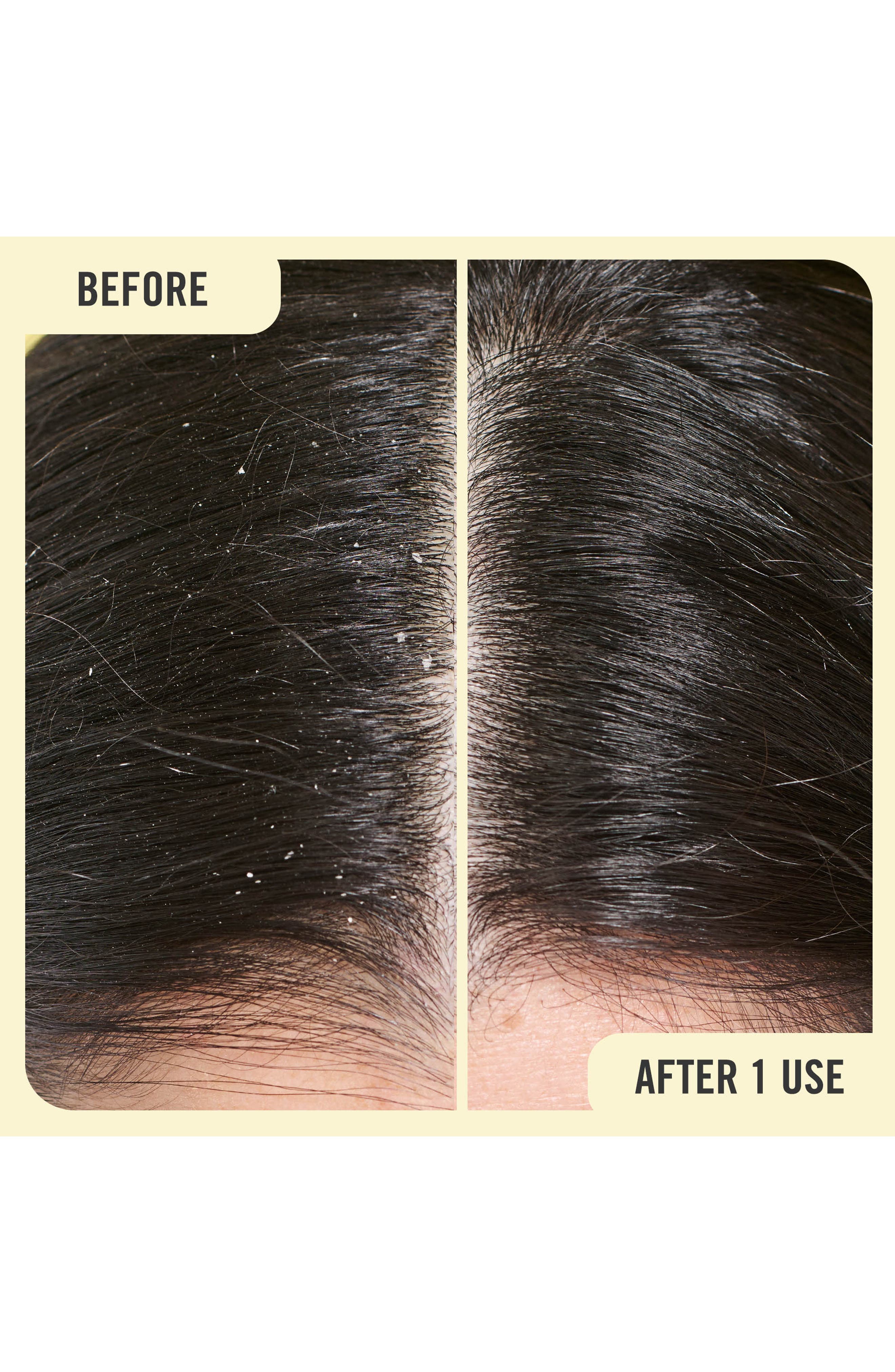 First Aid Beauty AntiDandruff Shampoo Nordstrom