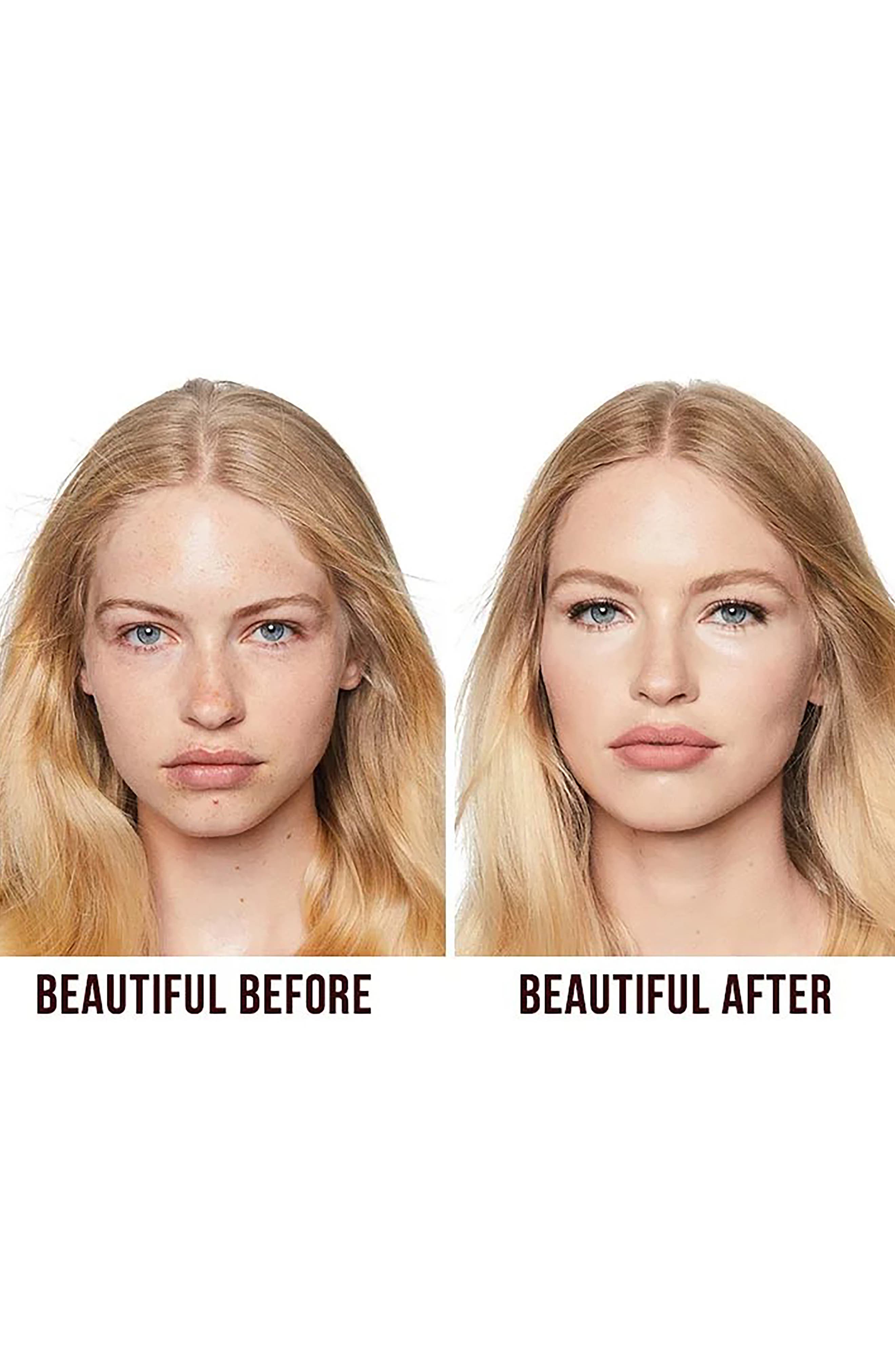 charlotte tilbury magic cream rosacea