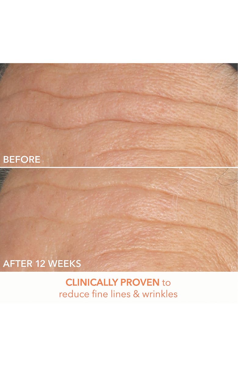 Dr. Dennis Gross Skincare Alpha Beta® Peel Original Formula 30