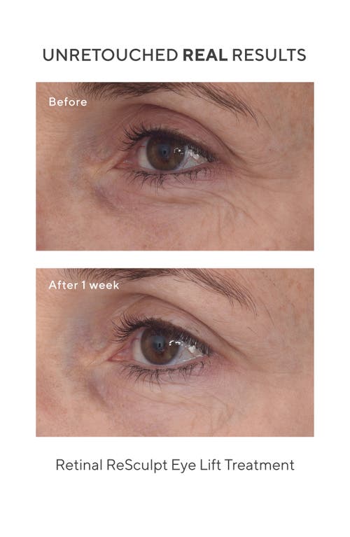 MURAD MURAD® RETINAL RESCULPT EYE LIFT TREATMENT 