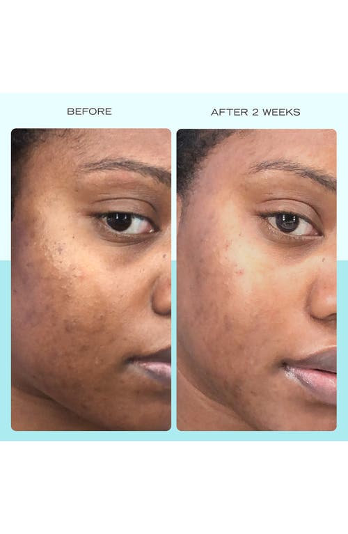 First Aid Beauty Dark Spot Serum With Niacinamide In No Color