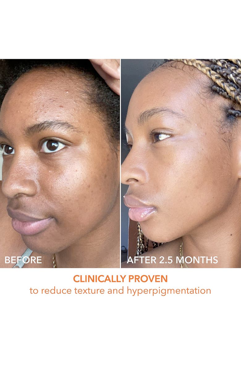 Dr. Dennis Gross Skincare Alpha Beta® Peel Original Formula 30