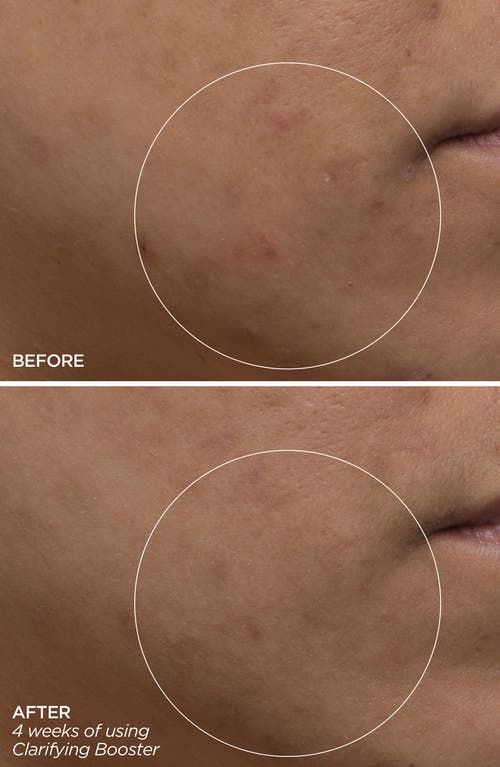 Beautybio Clarifying Salicylic Acid Booster Serum In No Color