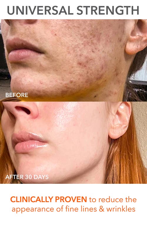Dr Dennis Gross Skincare Dr. Dennis Gross Skincare The Science Of Glow Set $245 Value In No Color