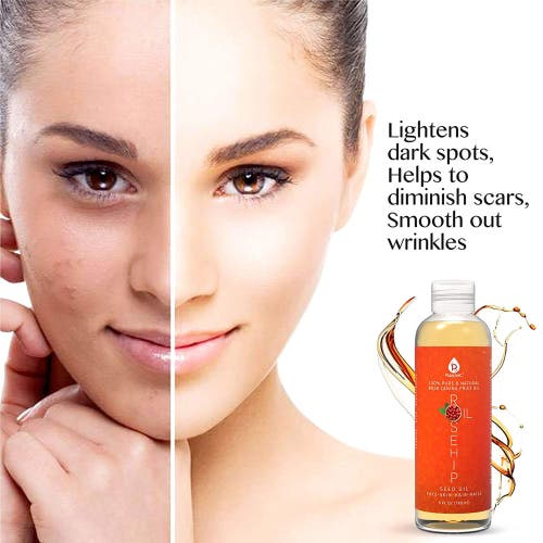 Pursonic 100% Pure Rosehip Oil 6 oz In Multicolor