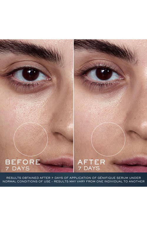 Shop Lancôme Advanced Génifique Youth Activating Concentrate Anti-aging Face Serum In No Color