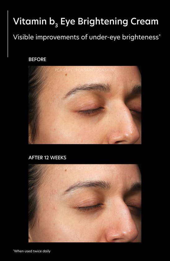 Pca Skin Vitamin B3 Eye Brightening Cream ModeSens