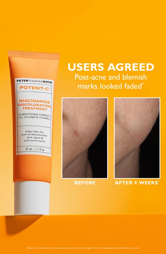 Shop Peter Thomas Roth Potent-c Niacinamide Discoloration Treatment