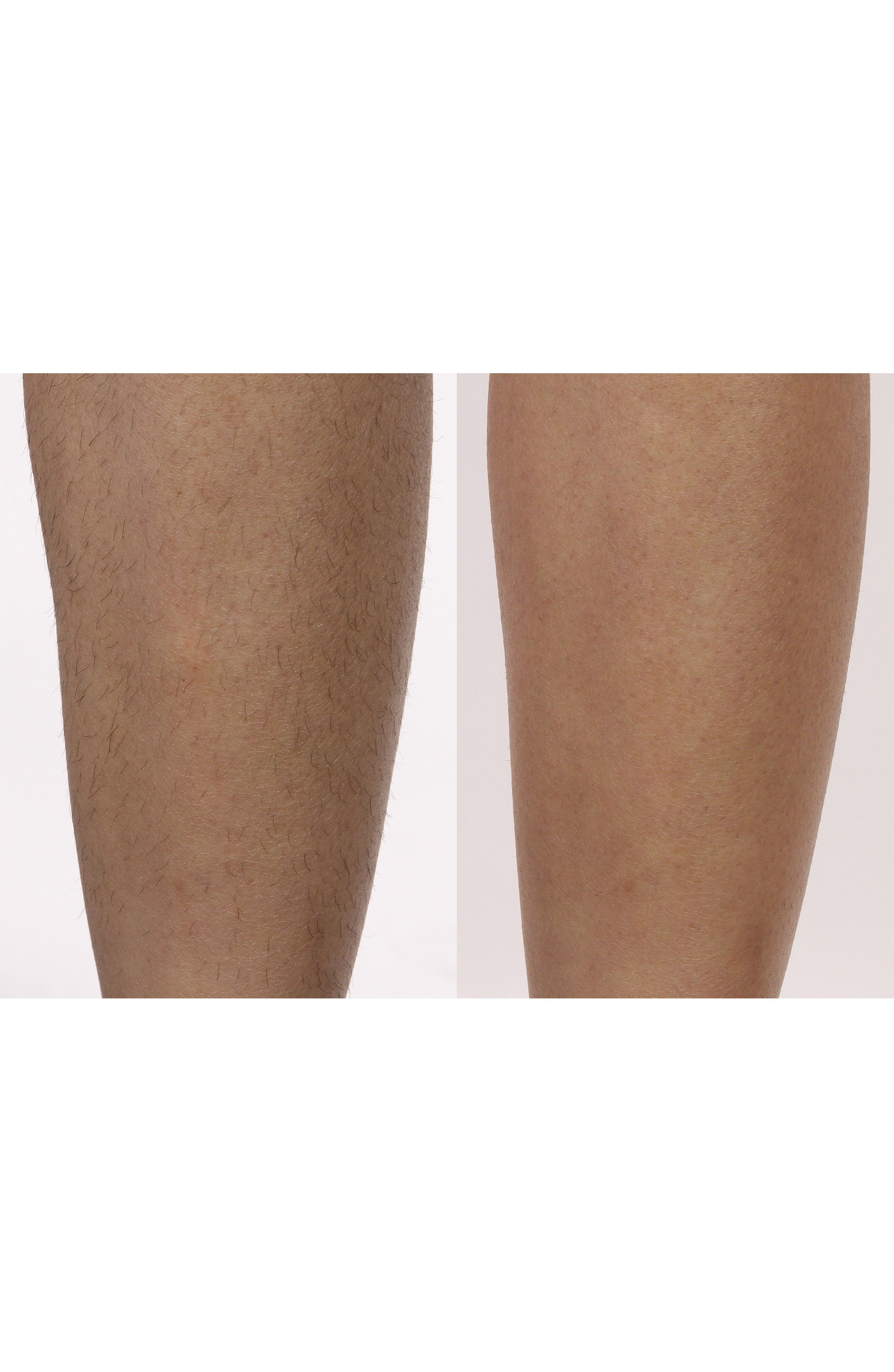 Silk'n Flash & Go Express Hair Removal Device Nordstrom